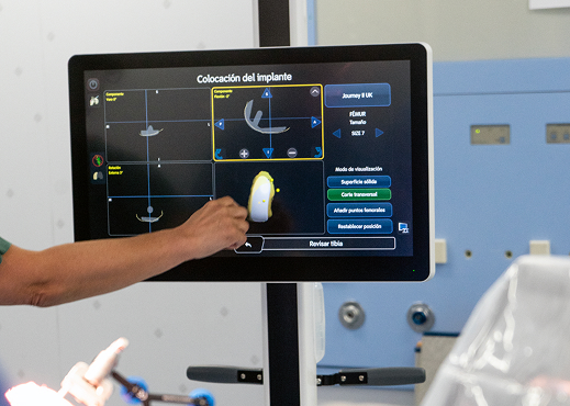 Cirugía robótica de rodilla en Sevilla